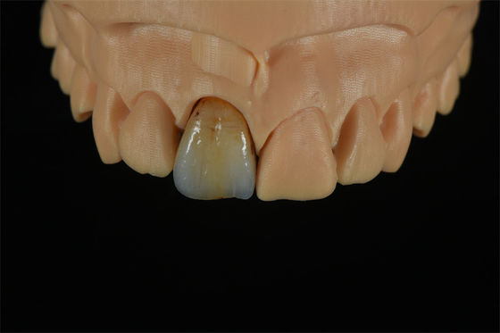 গুণ  Affordable Zirconia Crowns with Custom Color Staining - China Dental Lab কারখানা